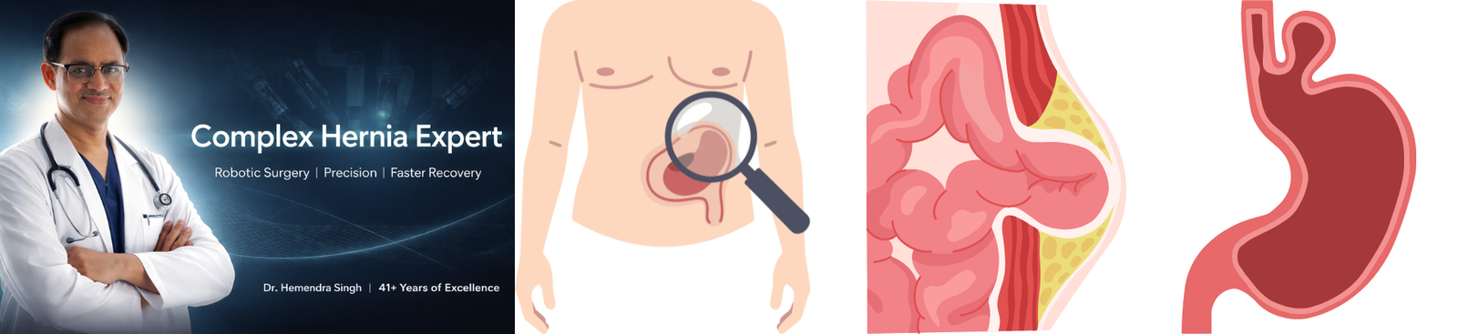 Complex-Hernia-Surgery-Expert.png